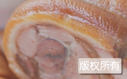 捆肘卷