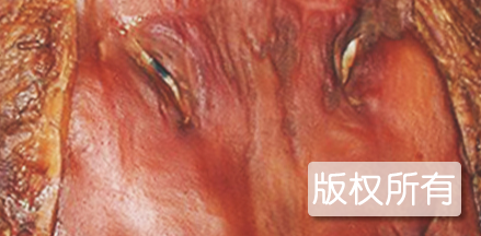 蝶式腊猪头