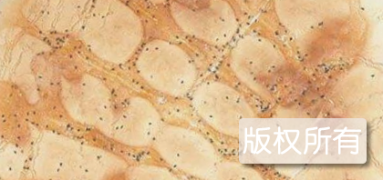 余锅盔